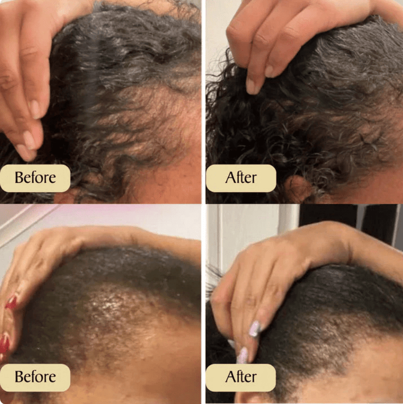 Hair Growth Oil